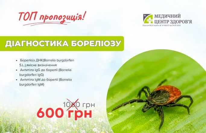 Комплекс “Діагностика бореліозу”