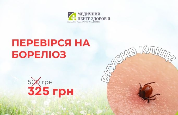 Комплекс “ДНК бореліоз”
